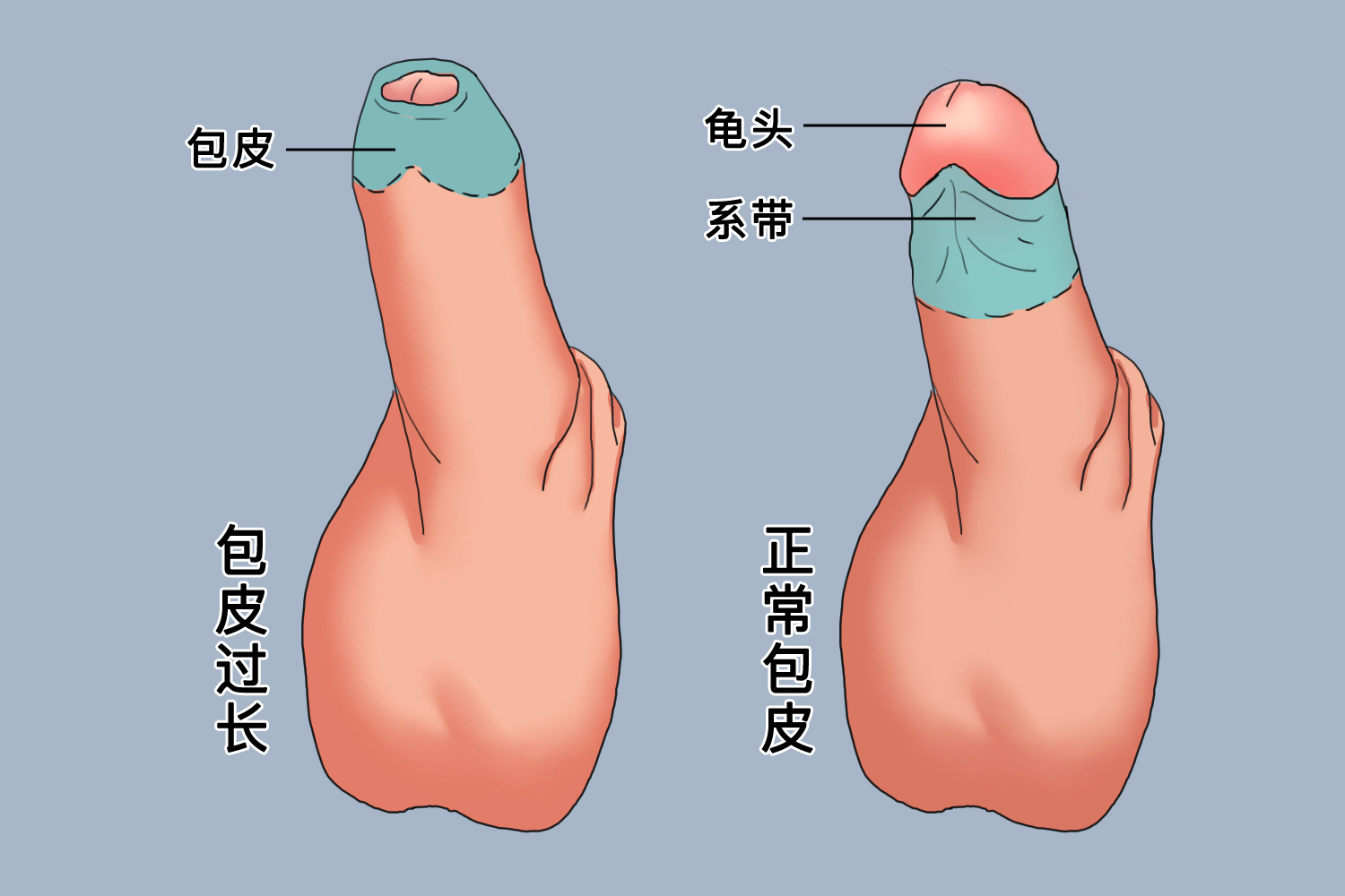 正常包皮的圖片及其相關(guān)知識(shí)科普，包皮圖片及其相關(guān)知識(shí)科普介紹