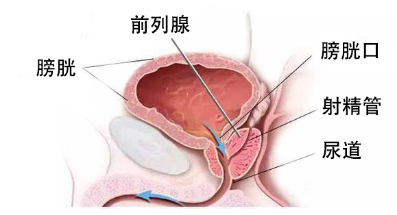 普樂安片治療前列腺炎的療程與效果，深度解析，普樂安片治療前列腺炎療程與效果深度解析，療程長短與治療效果一覽無余。